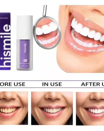 HISMILE  Crema Blanqueadora Dental