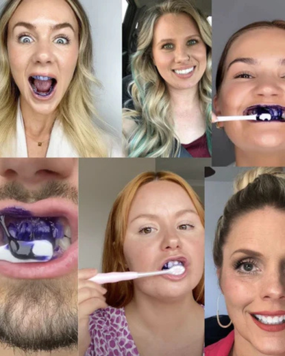 HISMILE  Crema Blanqueadora Dental